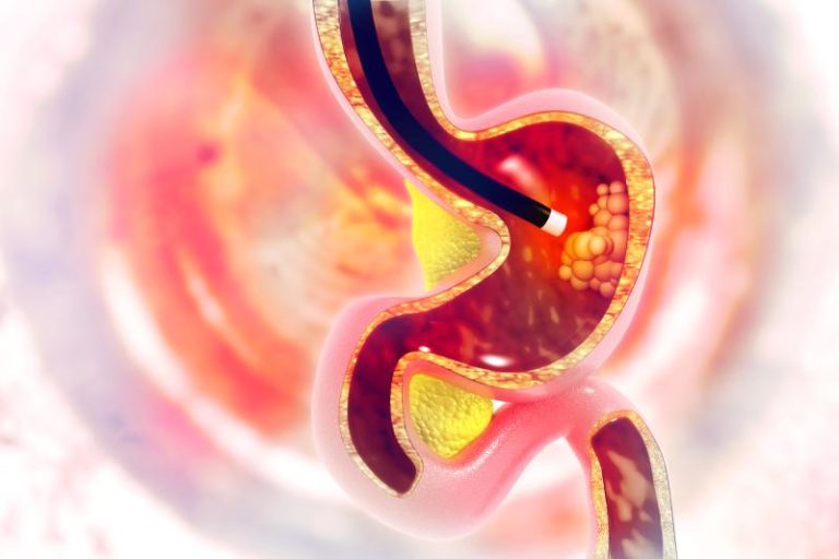 Endoscopia Incan Clinicas y Servicios – Gastroenterologia Hospital Universitario UANL